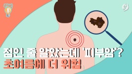 [리빙톡] 점인 줄 알았는데 피부암?…초여름에 더 위험
