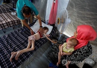 뼈만 앙상한 아이들…