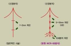 대구탑성형외과, 종아리 퇴축술로 완성하는 여성의 매끈한 뒤 태 라인!