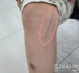 [단독] 용인대 총장배 금메달 유도선수의 미래 앗아간 부산체고