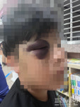힘들어서 그만두겠다는 아동을 피멍 들도록 때린 태권도 사범