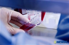 제대혈, 신용카드 포인트로 결제