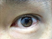 올바른 콘택트렌즈 관리로 즐거운 피서를…