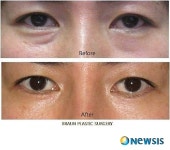 브라운성형외과, 브라운아이드걸스 눈매가 가장 매력적