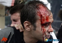 유혈 낭자한 그리스 시위대