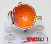 라식수술 후 눈 관리를 위해 필요한 영양소