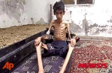 시리아 마다야 주민 등 아사 직전…굶주린 아이 먹을거 가져왔어요?