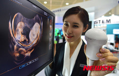 산부인과용 첨단 초음파 전자기기