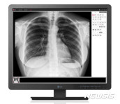LG전자, 의료용 영상기기 ‘풀라인업’ 갖췄다
