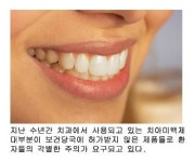 “비담처럼 해주세요” 불법미백제 치아엔 ‘독’