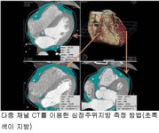 “심장 주위 지방 많으면 심혈관계 질환 위험 높아”