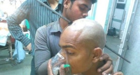 철근에 머리 관통당한 공사장 인부…“생존은 기적”