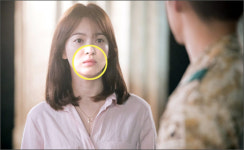 ‘태후 송혜교 인중처럼 똑같이요!’ 강남 일대 성형 바람