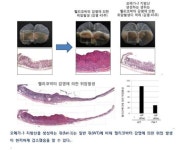 등푸른 생선 오메가-3, 위암·크론병 등 예방 효과