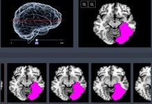 ㈜제이엘케이인스펙션, 국내 최초 인공지능(AI) 활용 ‘의료영상진단 분야 의료기기’ 허가 절차 돌입