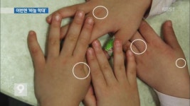 ‘바늘 학대사건’ 남양주 어린이집 교사 무죄… 왜?