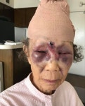 85세 노인을 이렇게… LA한인타운서 벌어진 ‘묻지마 폭행’