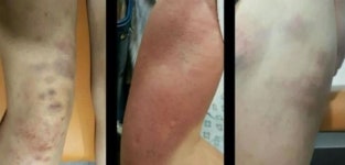 피해자 언니가 밝힌 ‘관악산 여고생 집단폭행’의 전말 (인터뷰)