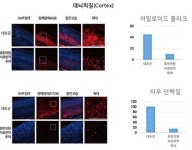 한방 신물질, 알츠하이머병 예방·치료 가능성 확인