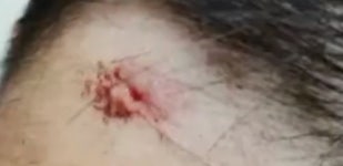 “운동 게으르게 한다” 무술수업 도중 학생에게 봉 던진 中 강사