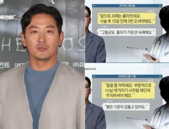 “하정우 입니다, 얼굴 흉터가 숙제예요” 병원장 문자 공개