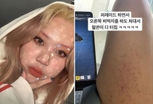 “허벅지 혈관 터짐” 래퍼 이영지가 투잡 뛰는 이유