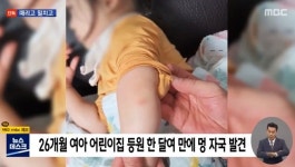 “두살배기 때리고 내동댕이치고” 또 어린이집 아동학대