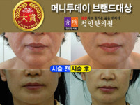 [머니투데이 브랜드대상] 양심적이고 실력있는 한방성형, 체형교정전문 한의원 청인한의원