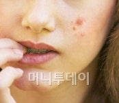 여드름 예방, 꼼꼼한 모공관리가 중요