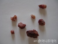 [장윤호의 체인지업] 배영수는 7개의 뼛조각을 기억하는가
