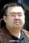 김정남 마지막 말 매우 고통스럽다. 액체 스프레이 맞았다