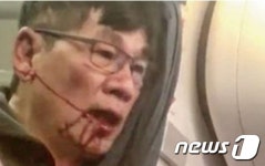 승객 끌어내린 유나이티드 항공… 피해자 신상 턴 美언론