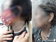 머리 염색하니 얼굴이 까맣게…헤나염색 부작용
