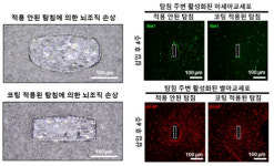 인체삽입 의료기기에 이것 바르면 수명 4배 이상↑