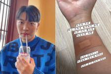 최고기, 가시 빼러 병원 갔다가 과잉 진료?…집게로 살 다 뜯어