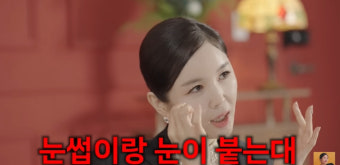 장영란, 눈 성형 3번 고백…