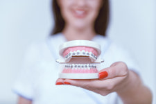 부쩍 많아진 중년 치아교정…이것 먼저 안하면 효과 없어