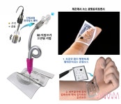 피부에 잉크 한 방울 톡…부드럽게 잠입해 질병 치료한다