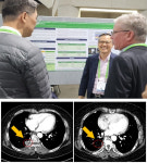 제이인츠바이오, AACR서 새로운 4세대 EGFR TKI 포스터 발표