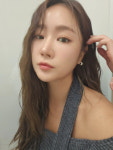 씨스타 소유, 렌즈 찢어져 각막 손상…눈 안 보여 너무 놀라