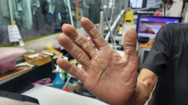 온통 굳은살, 거칠거칠…반값 세탁소 사장님, 건물주 된 비결은 진정성?