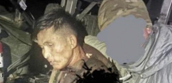 멍한 눈에 축 늘어진 마른 몸…우크라에 생포된 북한군 모습 보니
