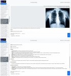 인텔리진소프트, 의료영상 판독 돕는 MediVision AI 출시