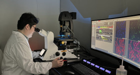 와이디생명과학-사피엔스바이오, 특발성 폐섬유증치료제 전임상 성공