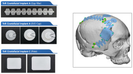 티앤알바이오팹, 2조 시장 CFI 美 FDA 승인 기대…3D 프린팅 성과
