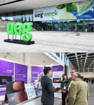 주식회사 아이넥스엠에이티 | 아이넥스, 'UEG Week 2025'서 의료 AI 솔루션 에나드 유럽 첫선