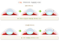 한 쪽 눈 가리고 
