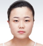 [전문의 칼럼] 서양에서는 미인, 우리나라에선 센 여자?