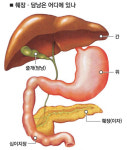췌장암 잘 걸리는 50~60대 복부초음파 검진을