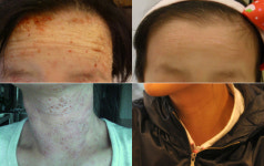 [편강한의원 건강기획시리즈 1부] ‘피부 미인되기’